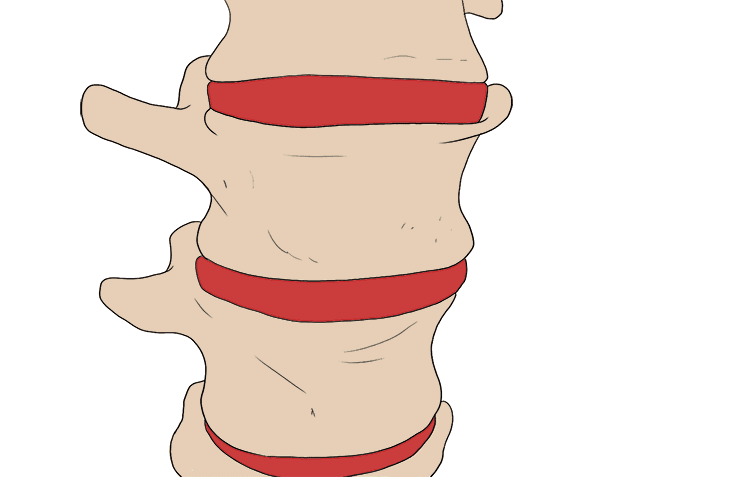 Between each pair of vertebrae are disks made of cartilage that act as shock absorbers, which allow slight movement between vertebrae.